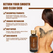 Tattoo Cleaning Agent Solution To Dilute Embroidery Pattern