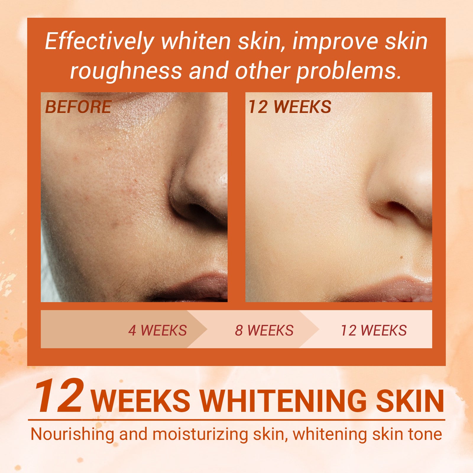 Skin Moisturizing And Fading Spray