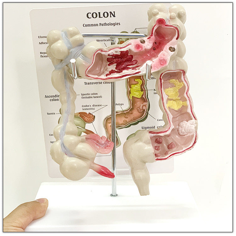 Anatomic Model Large Intestine Medical Human Anatomical Intestine Model – ALPSCOMMERCE