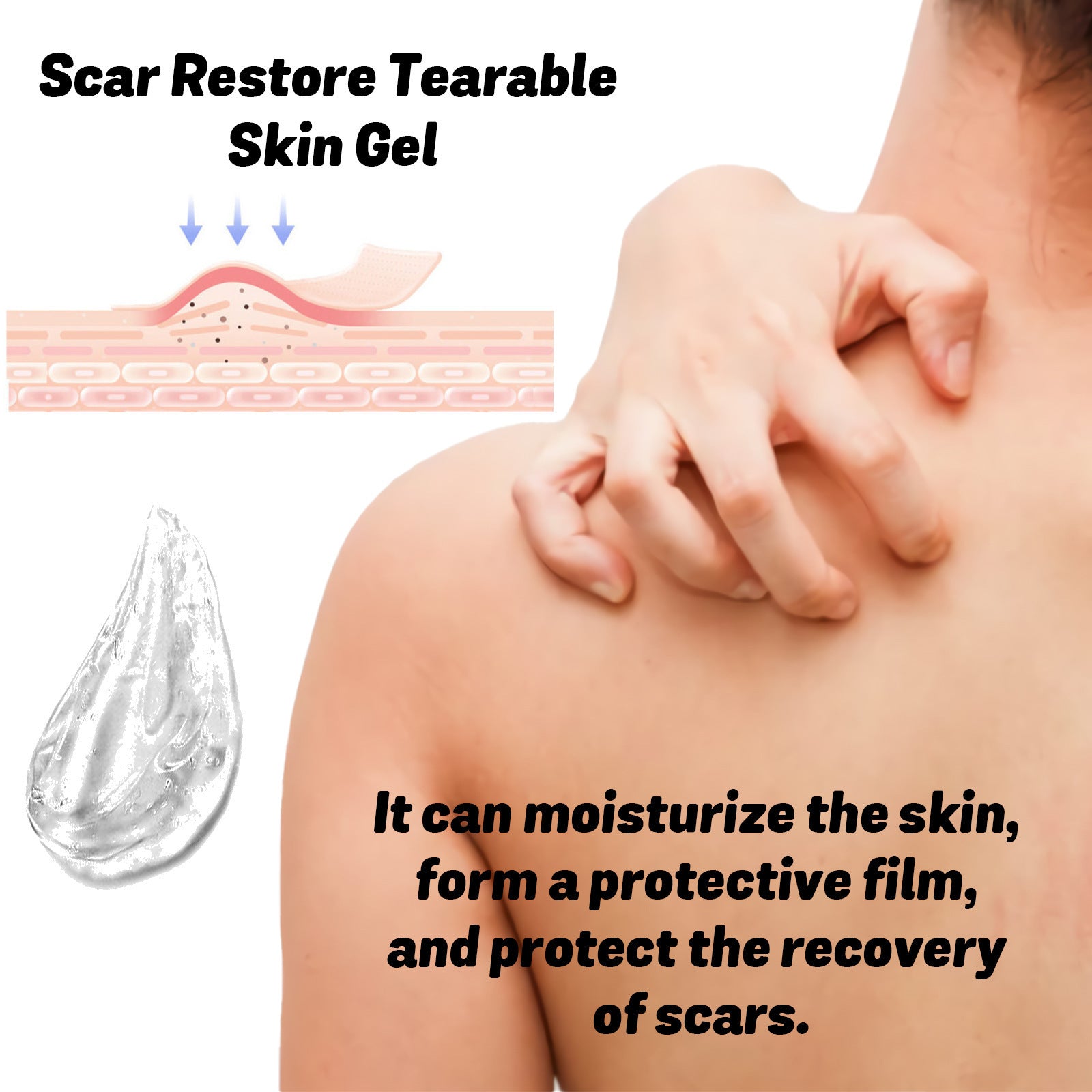 Skin Thinning Scar Care Gel