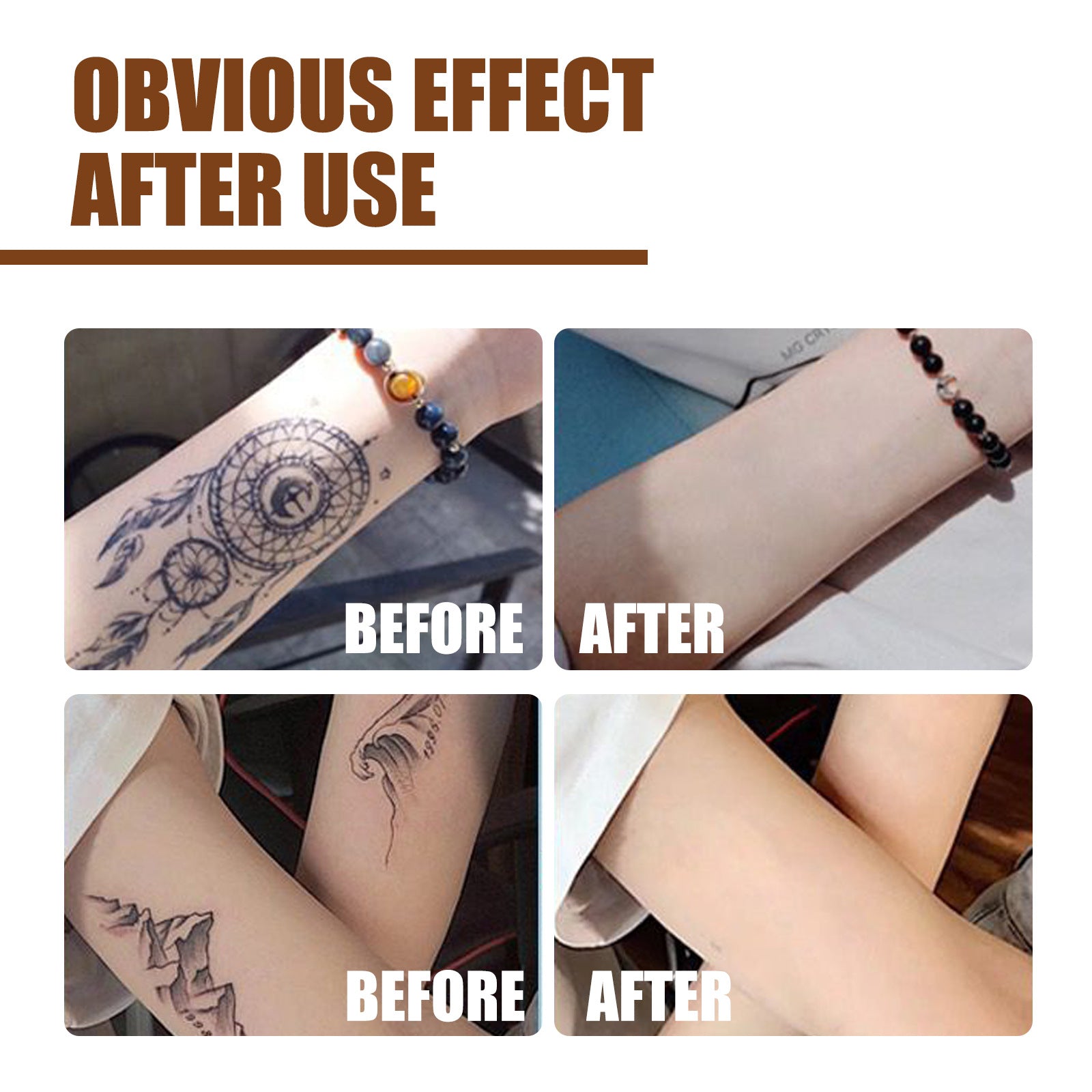 Tattoo Cleaning Agent Solution To Dilute Embroidery Pattern