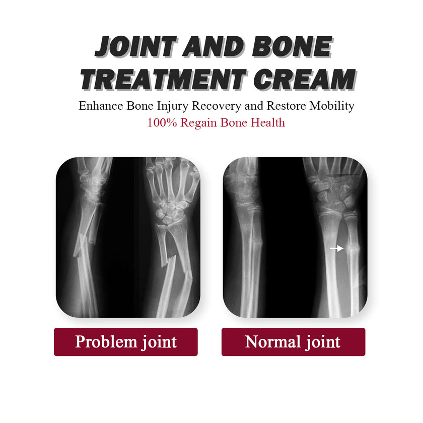 Protein Cream Soothes Joint Bone Soreness, Deformation, Correction And Repair Alpscommerce