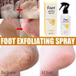 Brighten Spray To Remove Dead Skin And Calluses And Whiten Feet