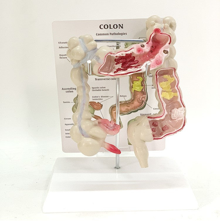 Anatomic Model Large Intestine Medical Human Anatomical Intestine Model – ALPSCOMMERCE