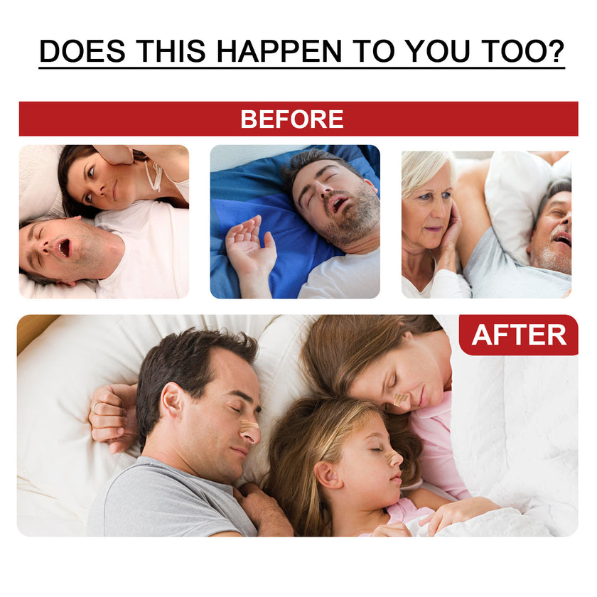 Night Snoring Stickers Elastic Anti-snoring