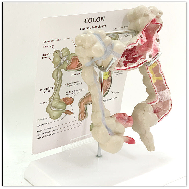 Anatomic Model Large Intestine Medical Human Anatomical Intestine Model – ALPSCOMMERCE