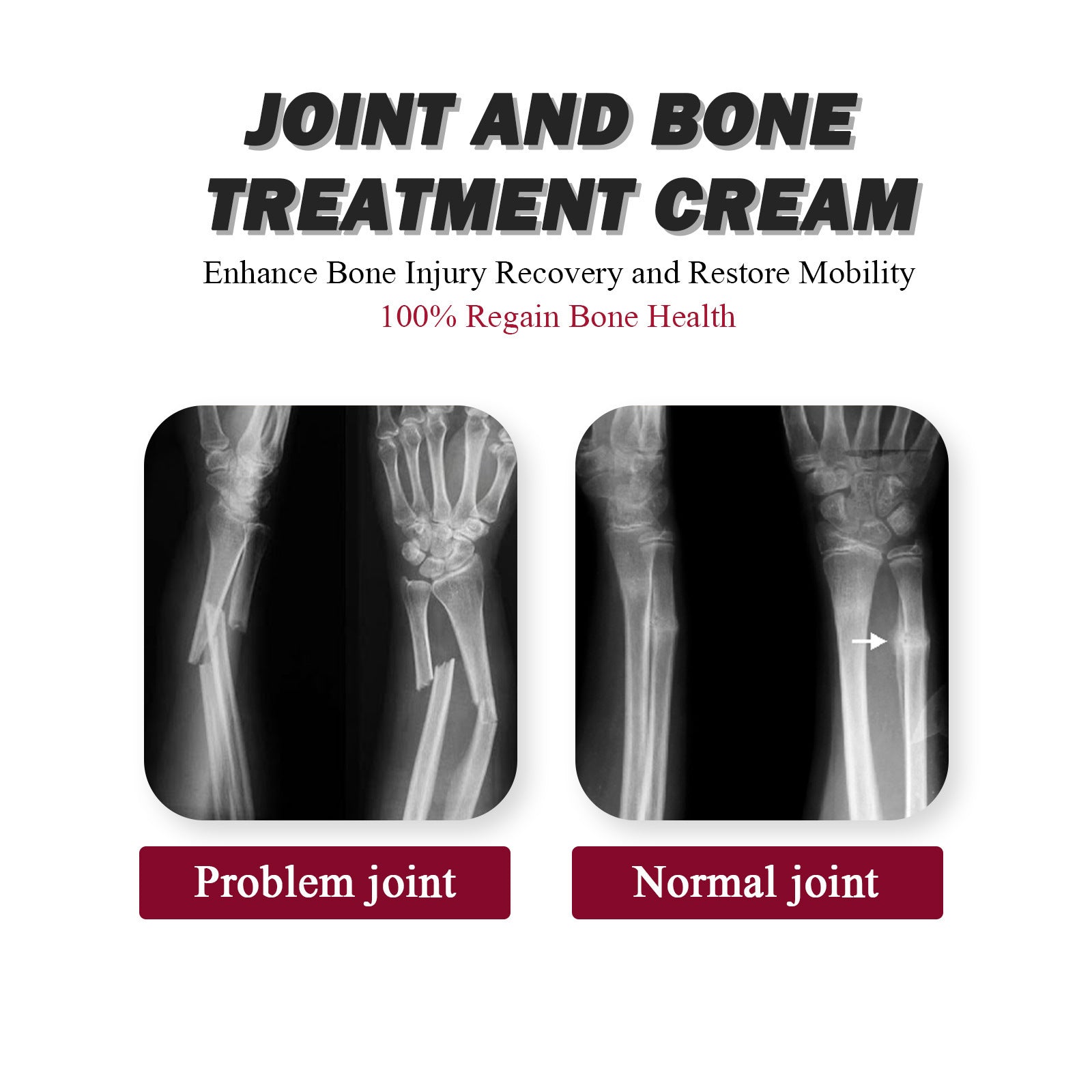 Protein Cream Soothes Joint Bone Soreness, Deformation, Correction And Repair Alpscommerce