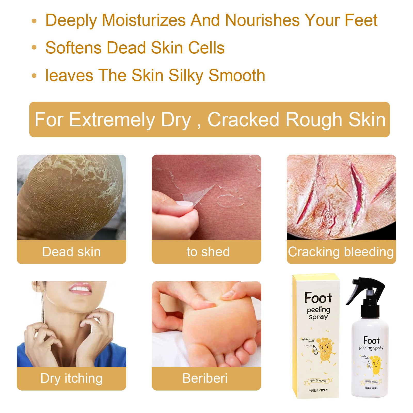 Brighten Spray To Remove Dead Skin And Calluses And Whiten Feet