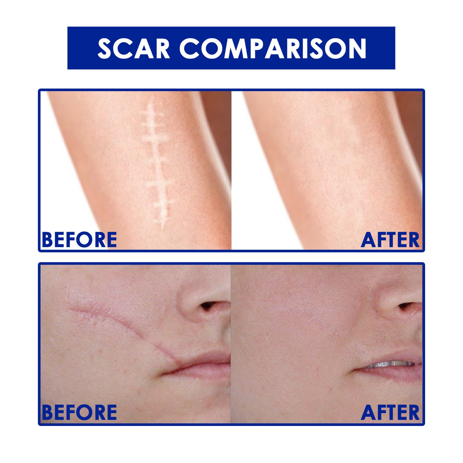 Skin Care Gel Skin Concave And Convex Wound