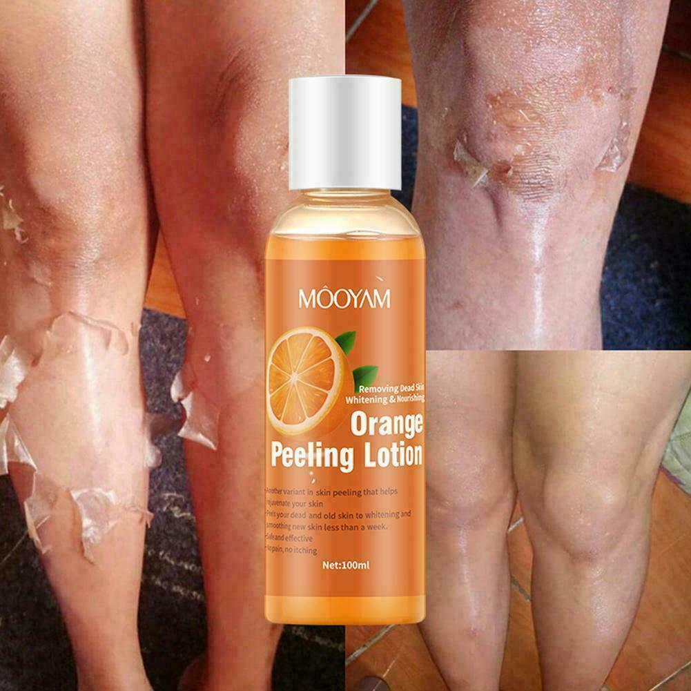 Instant Exfoliating Dead Skin Remover Brightening Exfoliating Gel Hot