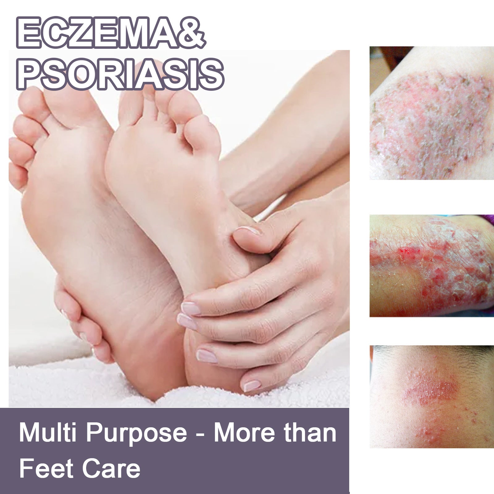 Hand And Foot Care Spray Relieves Dry Skin