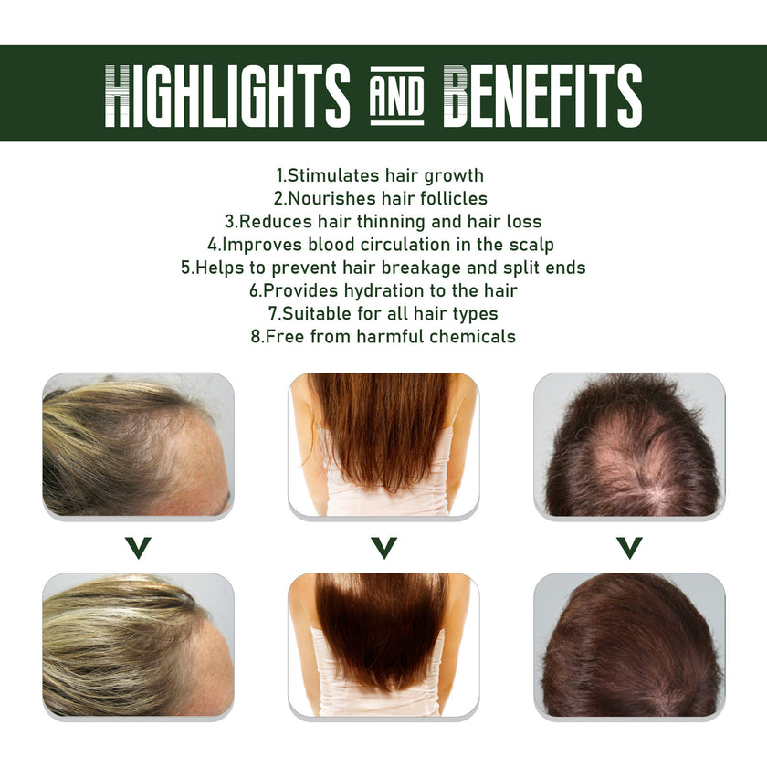 Ginger Dense Hair Spray Nourishing Hair Follicle Anti-hair Loss