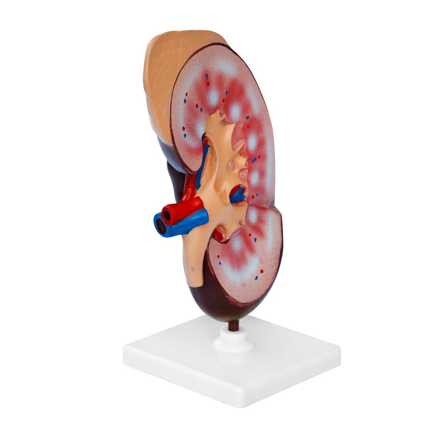 Kidney Biological Model Teaching Demonstration