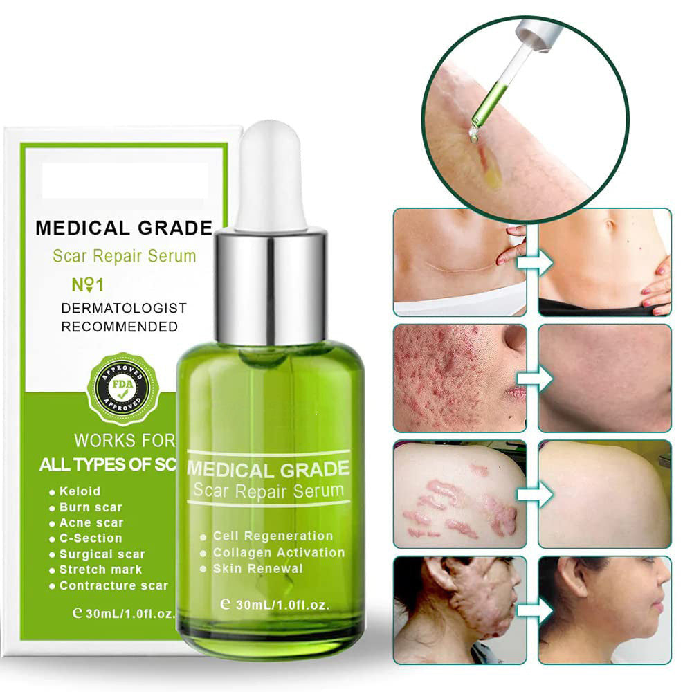 New Alpscommerce Scar Repair Body Care