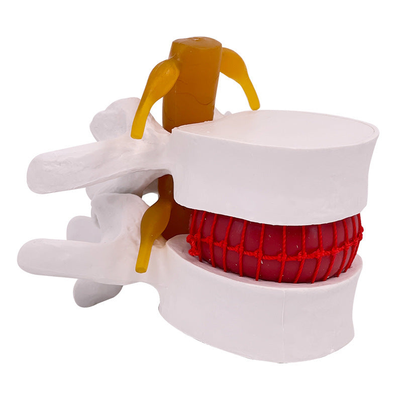 Lumbar Model Teaching Medical Human Body