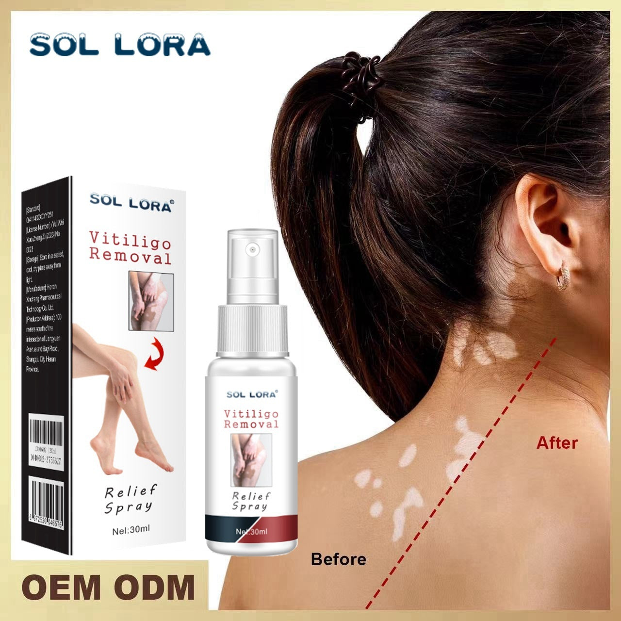 Moisturizing And Lightening White Spots, Flower Spots, Sweat Spots, Skin Care Spray