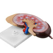 Kidney Biological Model Teaching Demonstration