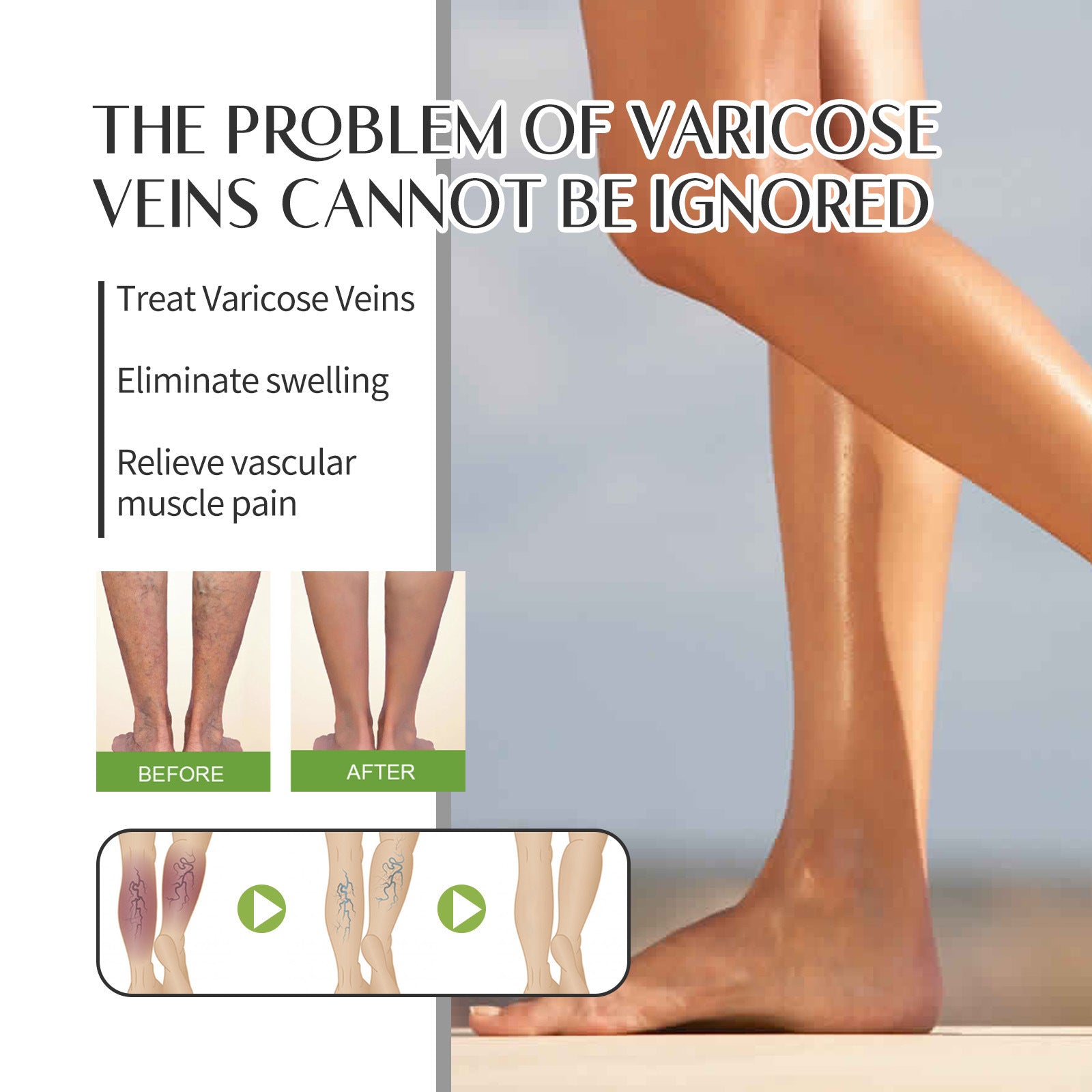 Intravenous Spray To Relieve Leg Muscle Soreness Care Spray