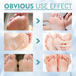 Calluses Repair Spray Foot Heel Anti-chapping Cleaning Cutin