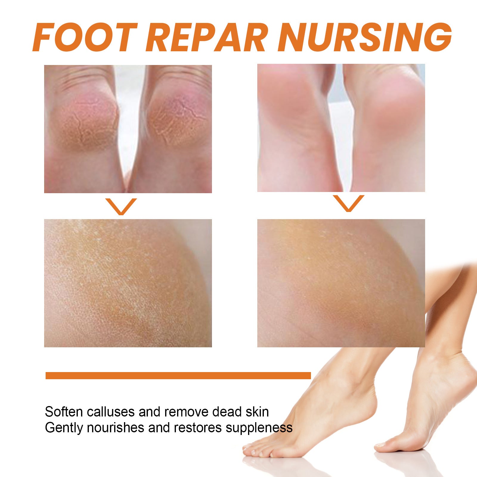 Foot Exfoliating Spray Mild Callose Remove Dead Skin
