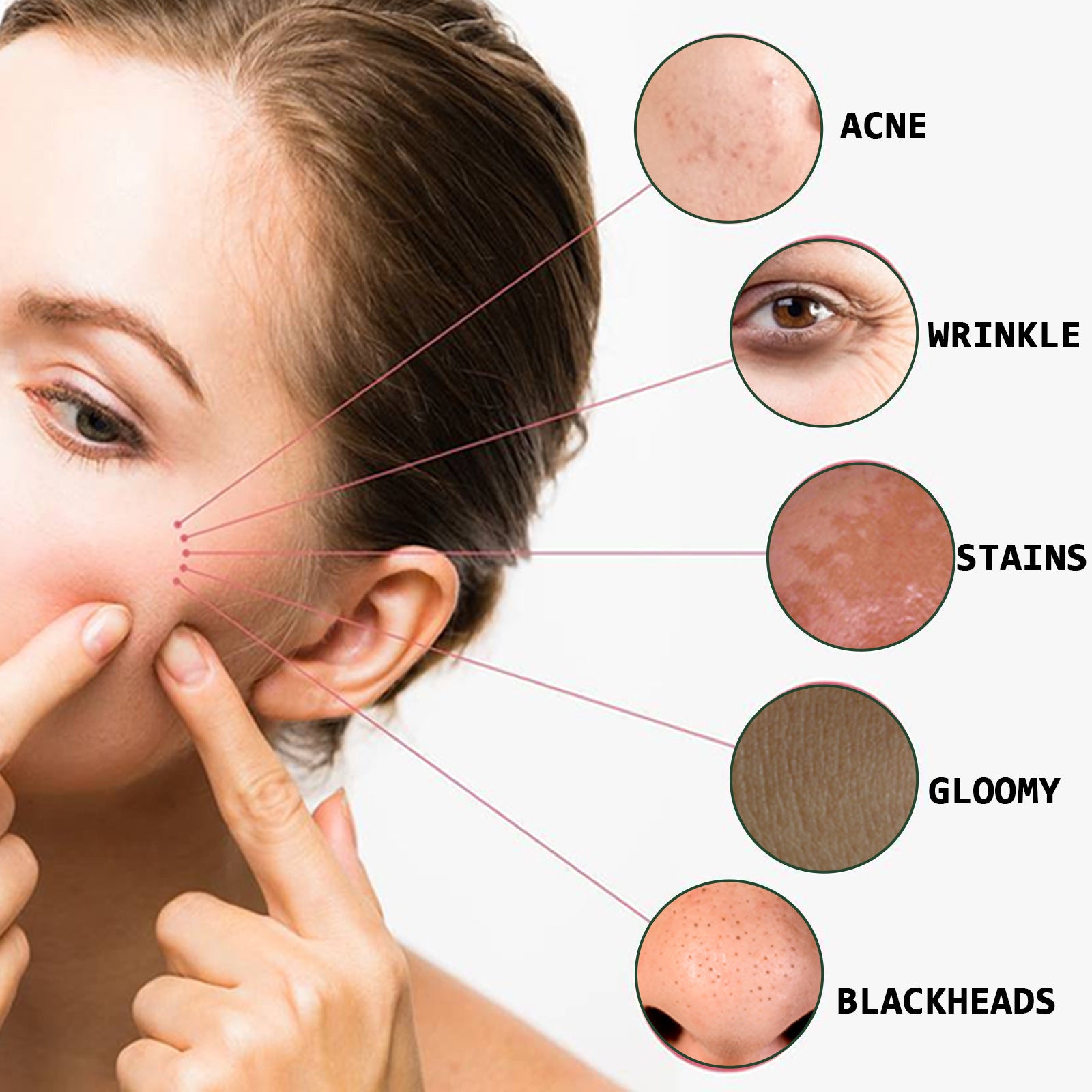 Acne Marks Blackhead Brightening Skin