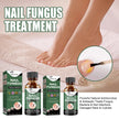 Foot Care Solution Onychomycosis Nail Care Solution