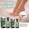 Foot Care Solution Onychomycosis Nail Care Solution