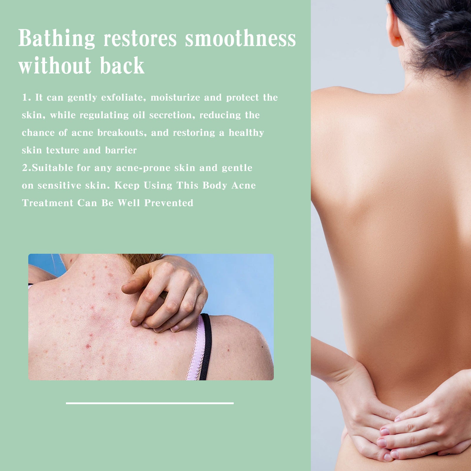 Back Acne Repair Back Shoulder Acne Desalination Acne Mark Skin Care Spray