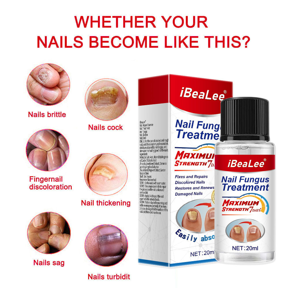 Thickening Of Special Bacteriostatic Liquid For Onychomycosis