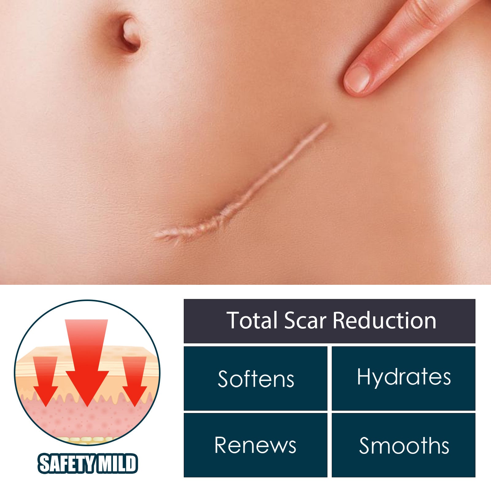 Skin Repair Gel Mild Care