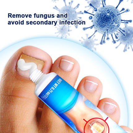 20g Onychomycosis Care Emulsifiable Paste