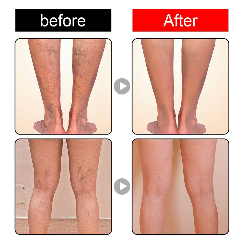 Body Neck Cream Care To Relieve Leg Discomfort