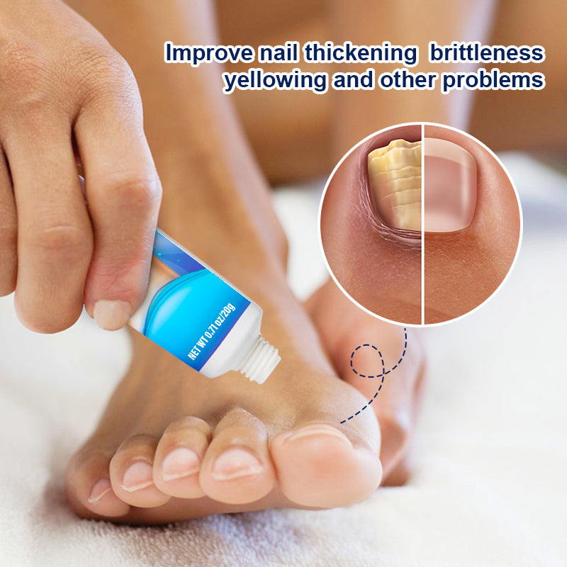 20g Onychomycosis Care Emulsifiable Paste