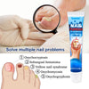 20g Onychomycosis Care Emulsifiable Paste