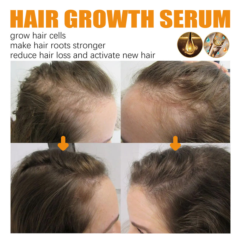 Hair Growth Repair Care Essential Oil Alpscommerce hair care oil