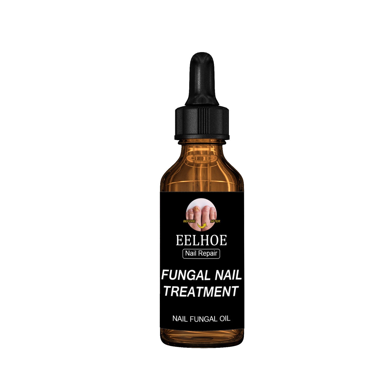 Onychomycosis Dead Skin And Repairing Lotion