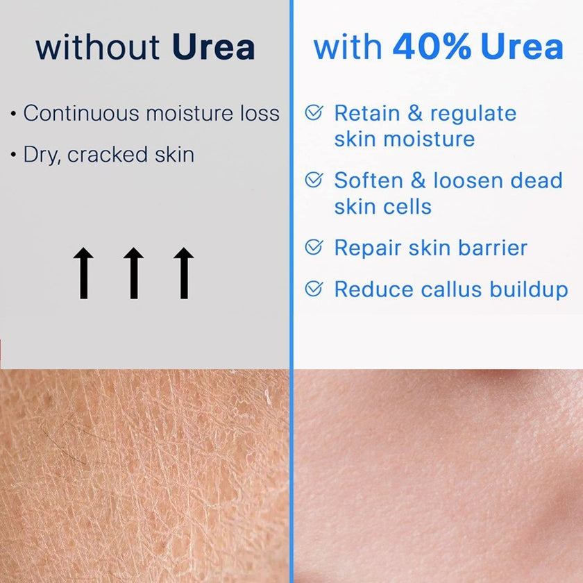 Foot Cream Calluses Removing Dead Skin Cleansing Cutin