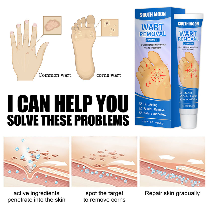 Remove Corns Cream To Smooth The Calluses