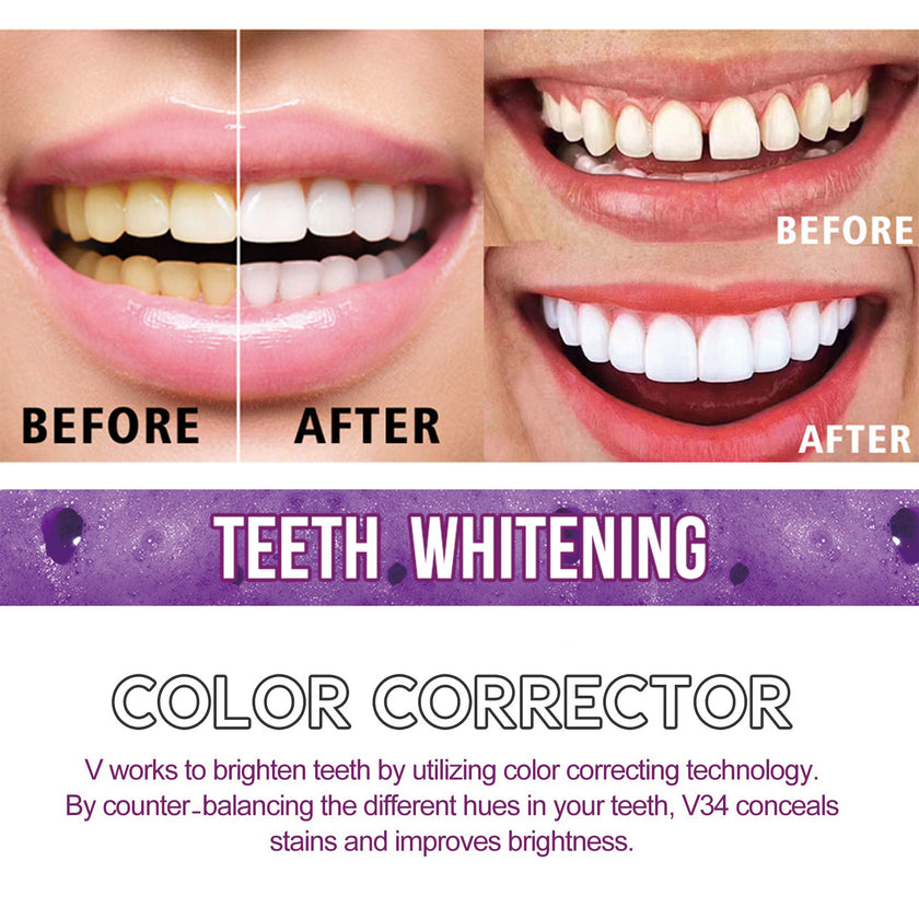 Teeth Cleaning Mousse Anti-moth Cleaning Yellow Teeth Tartar Breath Fresh Brightening White Beautiful Tooth Toothpaste