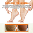 Foot Exfoliating Spray Mild Callose Remove Dead Skin
