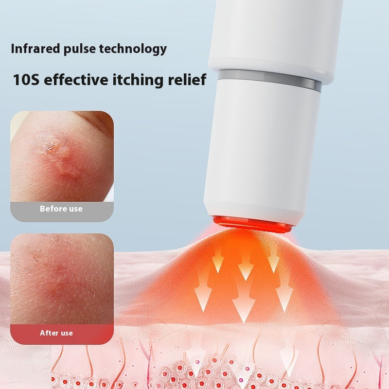 Mosquito Anti-itching Device Baby Mosquito Anti-itching Elimination