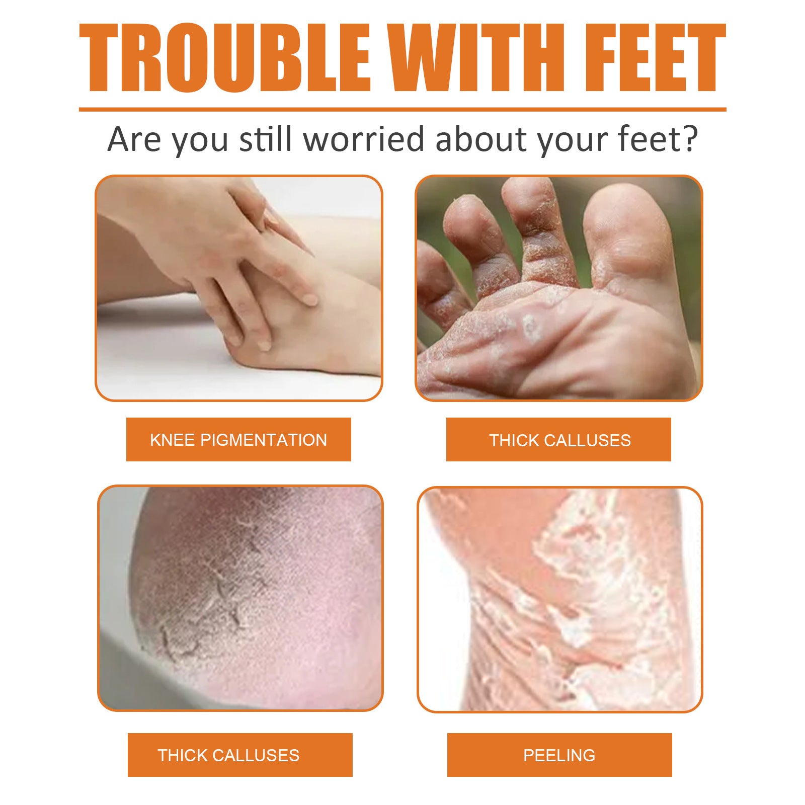 Foot Exfoliating Spray Mild Callose Remove Dead Skin