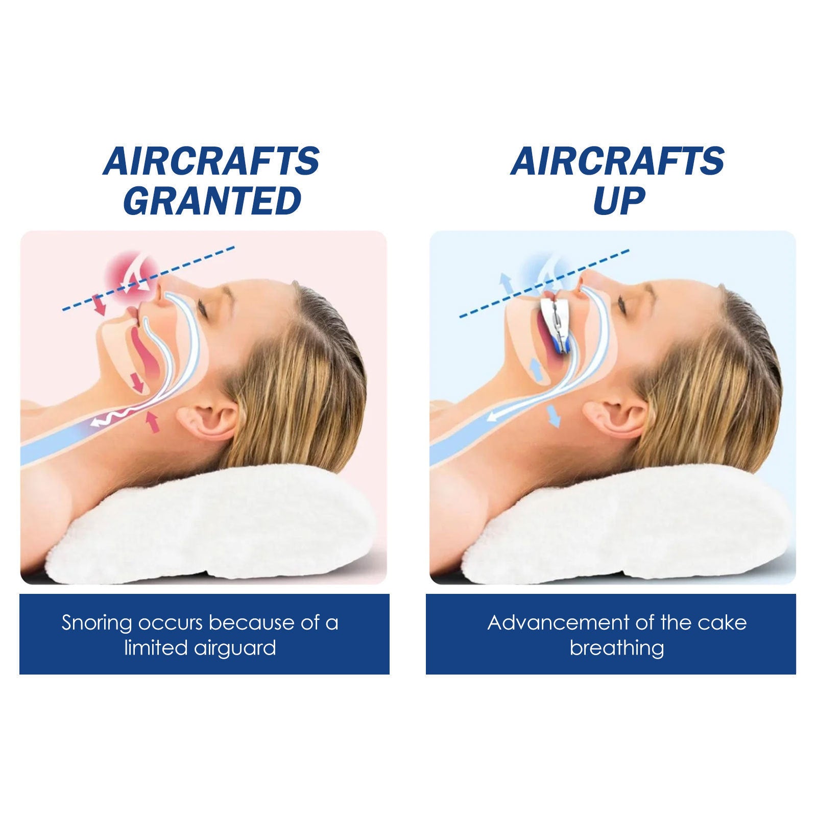 Anti-snoring Teeth Brace Anti-snoring Anti-grinding Breathing Smooth Braces