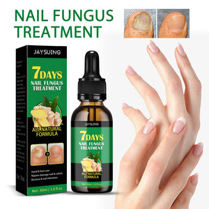 Ginger Nail Care Lotion Repair Hand And Foot Moisturizing