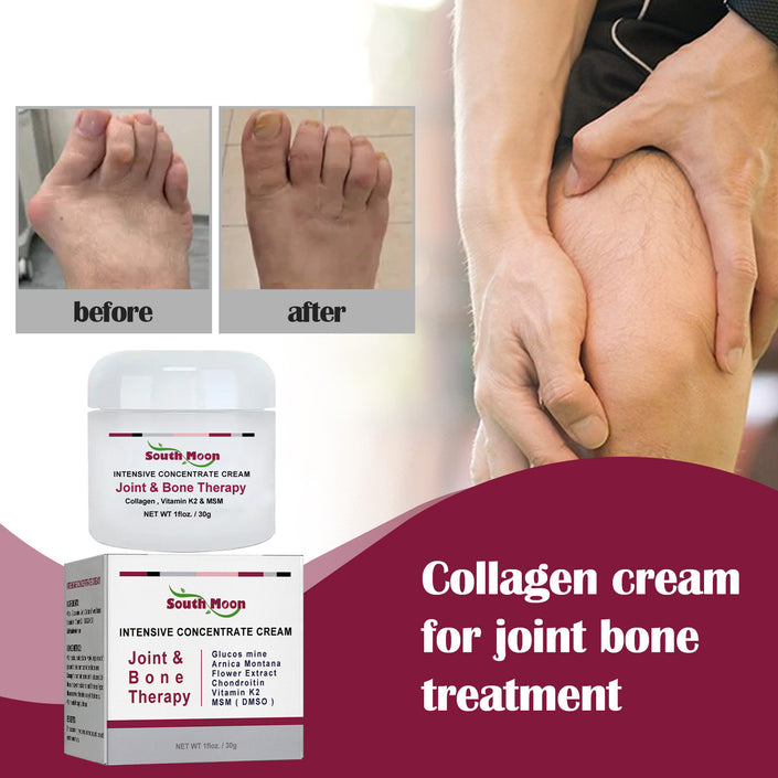 Protein Cream Soothes Joint Bone Soreness, Deformation, Correction And Repair Alpscommerce