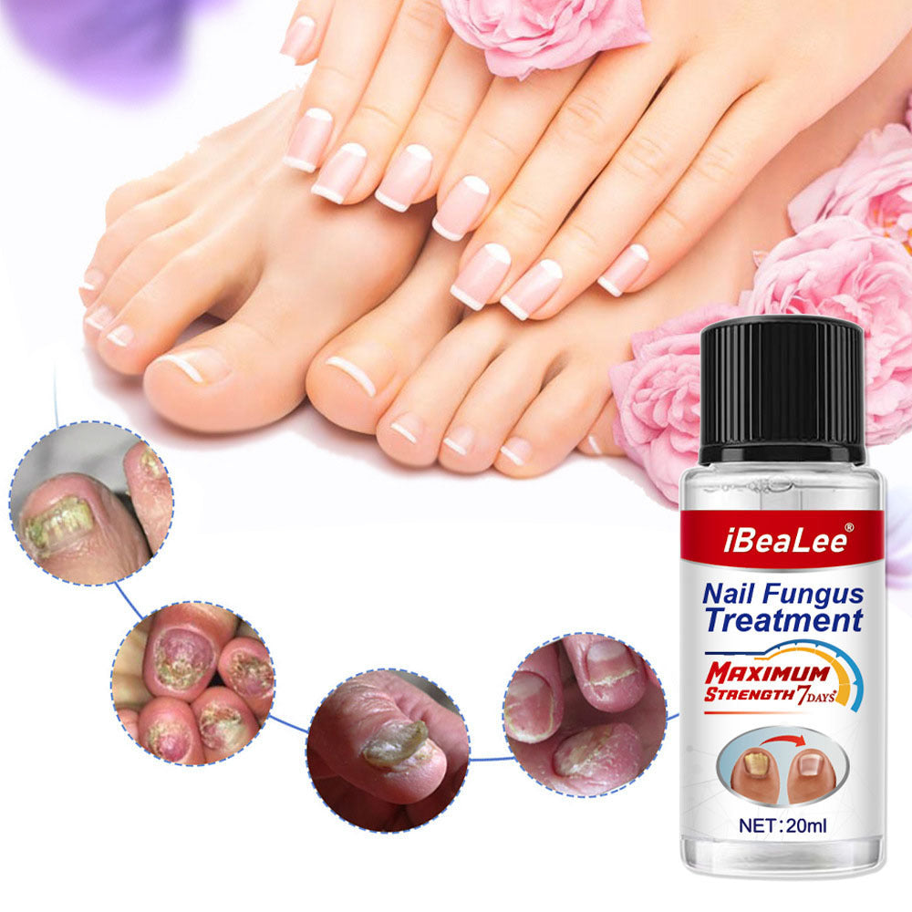 Thickening Of Special Bacteriostatic Liquid For Onychomycosis