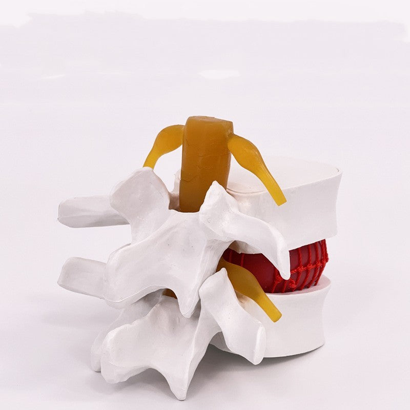 Lumbar Model Teaching Medical Human Body