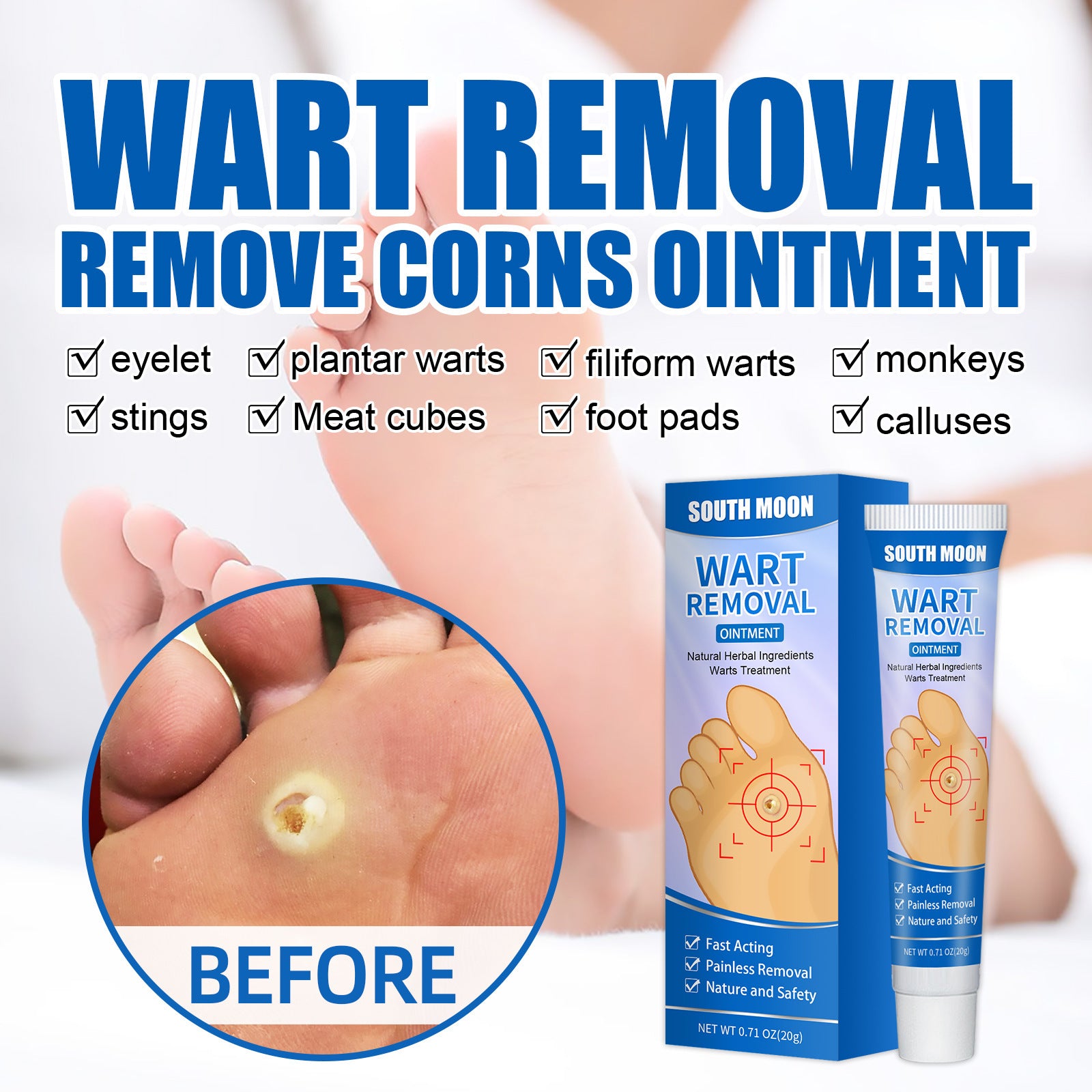 Remove Corns Cream To Smooth The Calluses
