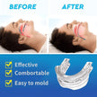 Adjustable Anti-snoring Device Snoring Silicone Tooth Brace