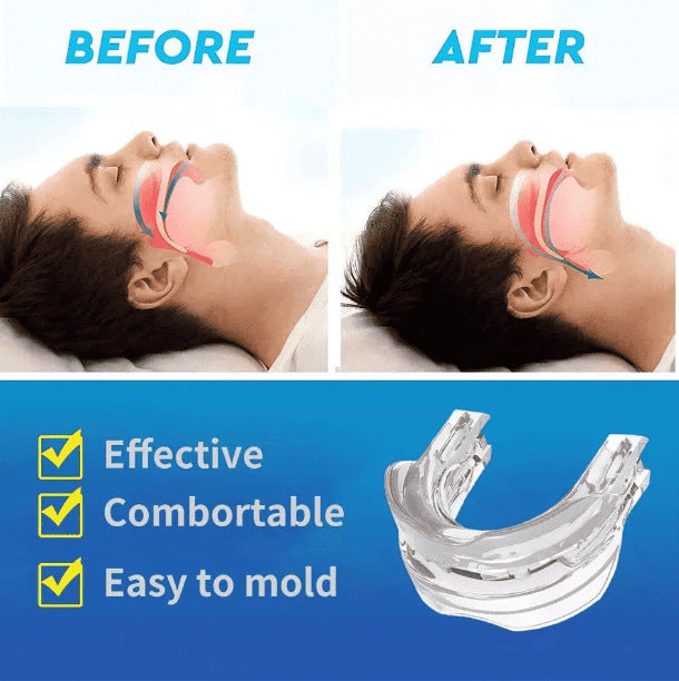 Adjustable Anti-snoring Device Snoring Silicone Tooth Brace
